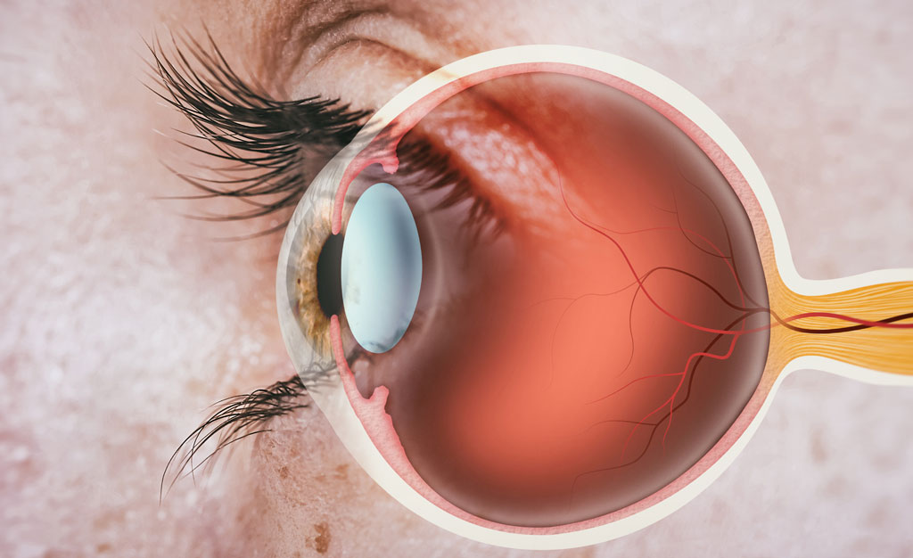 We diagnose eye diseases such as macular degeneration, glaucoma and cataracts.